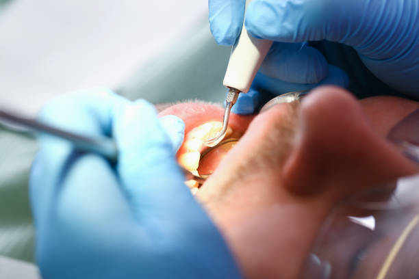 Best Urgent Care for Lost Fillings or Crowns in Glen Ridge, NJ