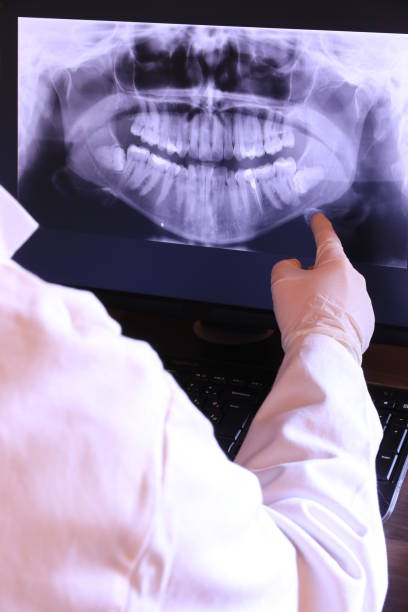 Best Emergency Root Canal Treatment in Glen Ridge, NJ